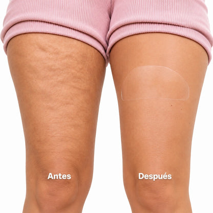 CINTA REAFIRMANTE INVISIBLE PARA LA CELULITIS Y LA FLACIDEZ. Utilízalas donde quieras!!